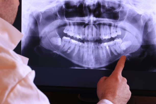 Best Orthodontic Emergency Dentist in Rockvale, TN