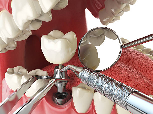 Best Emergency Cosmetic Dentistry in Rockvale, TN